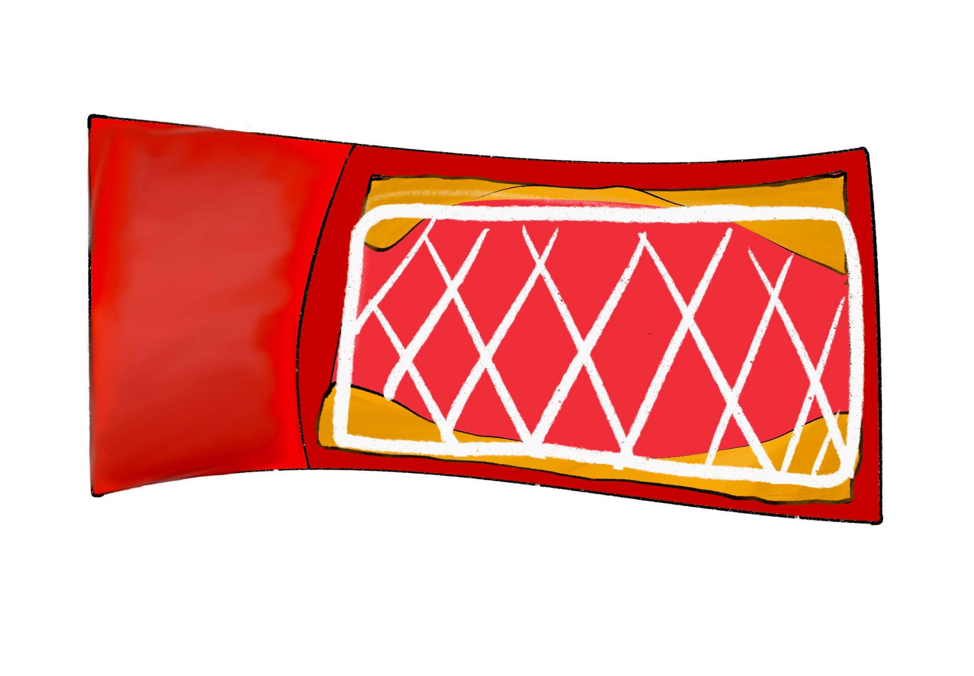 Fellow's close-up drawing of a mesh stent expanded inside a narrowed artery with plaque