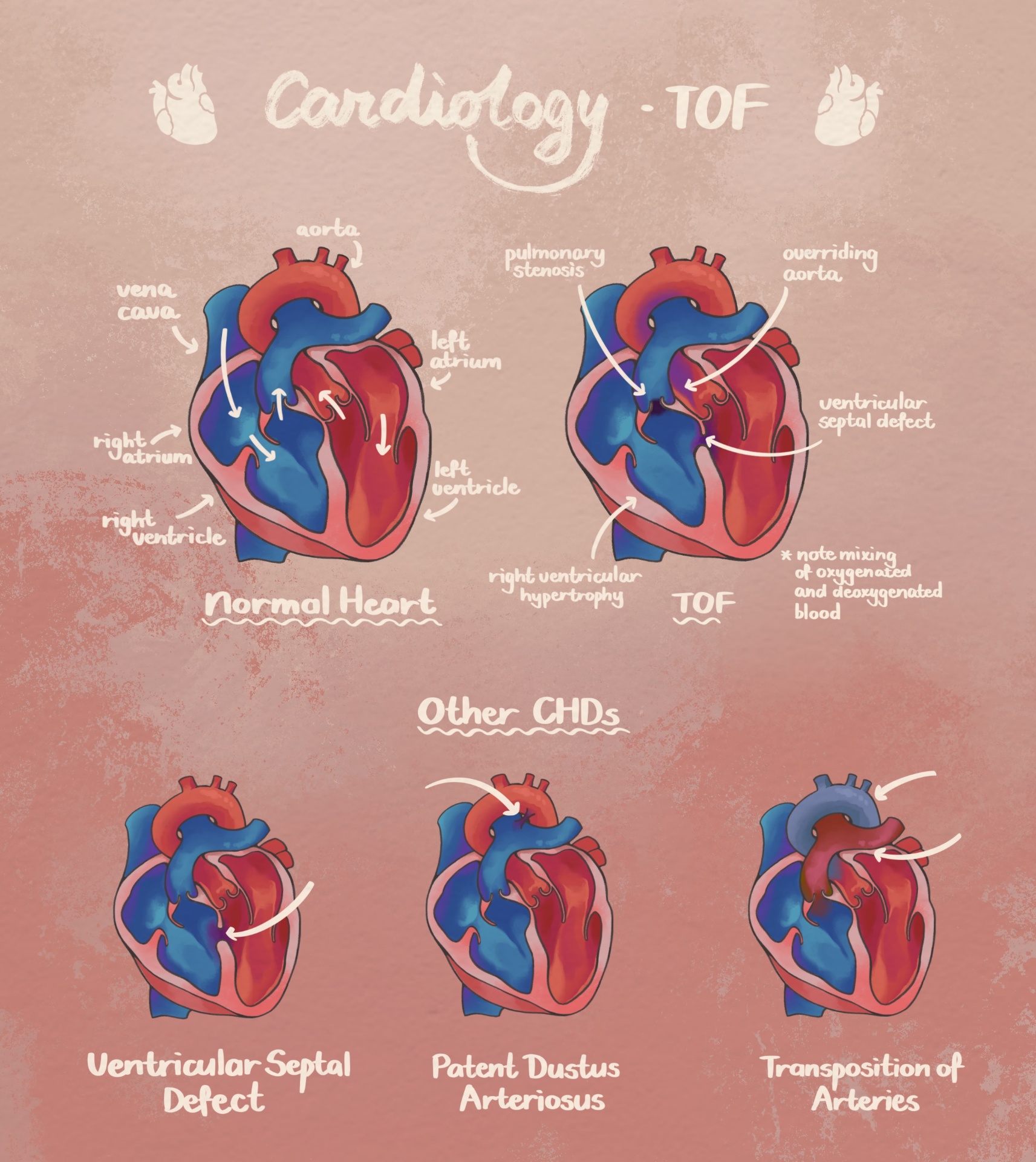 Fellow's illustrated guide to tetralogy of Fallot and other congenital heart defects